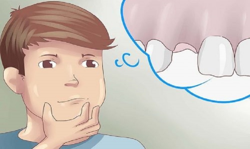 Mơ Thấy Gãy Răng Đánh Con Gì Trúng Lớn Tại VNSOXO?